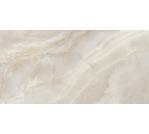 Керамогранит Delacora 60120ONB01M Оникс Бриз кремовый / Onyx Breez Crema 60×120